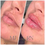 A woman with pink lips and her mouth open.